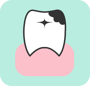 虫歯の症状